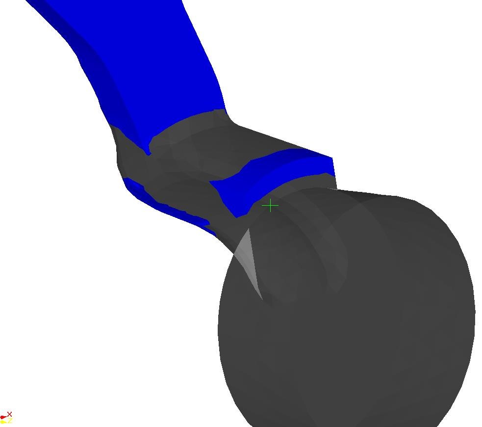ProCAST steering box simulation: air pocket due to missing fillet in the runner